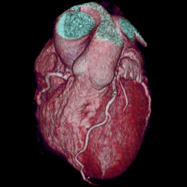 Un nuevo escáner logra estas increíbles imágenes de nuestro cuerpo