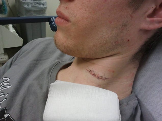Teen Pretends to Be Pregnant for April Fools Joke, Ends Up Stabbing Boyfriend in the Neck for Real