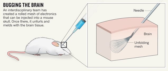 New Injectable Brain Implants Take Us One Step Closer To A Cyborg Future