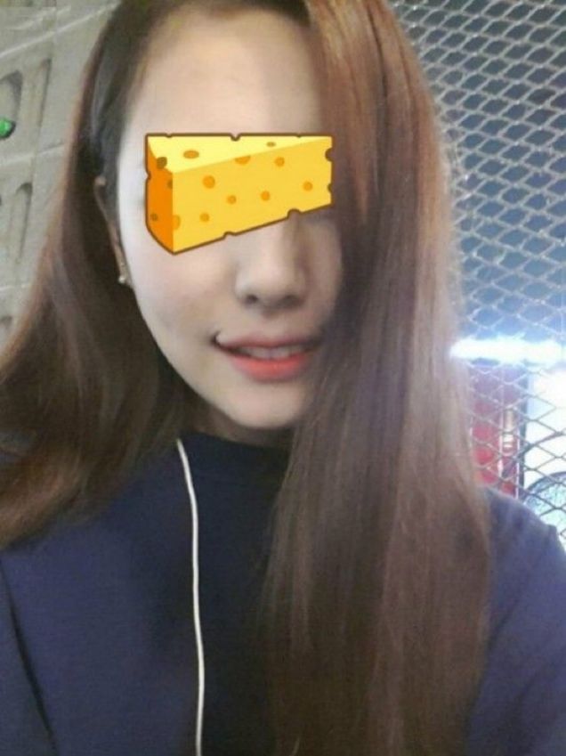 Joker Plastic Surgery? Permanent Duck Faces? I'm Not Sure Which!