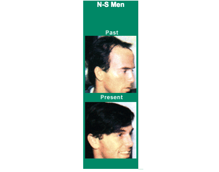 Is Donald Trump’s Hair a $60,000 Weave? A Gawker Investigation