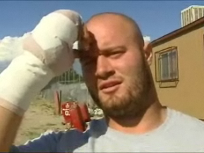 Lineman Chooses Amputation Over Surgery