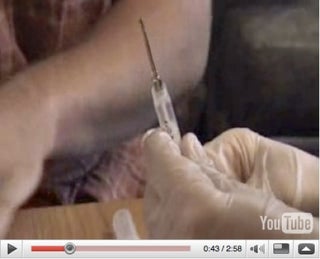 Stable, Sane Young Man Installs DIY RFID Implant into His Hand