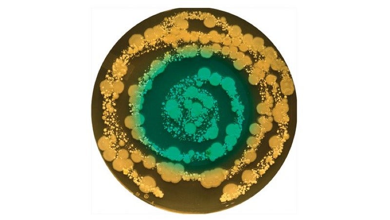 Your Navel Lint Makes a Beautiful Portrait as Unique as Your Fingerprint