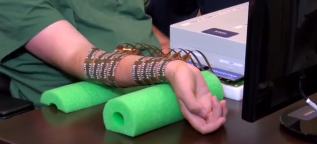Watch a Paralyzed Man Move His Hand With the Power of Thought