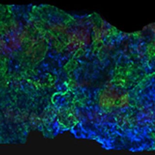 Artificial Bone That Morphs Into Tendons