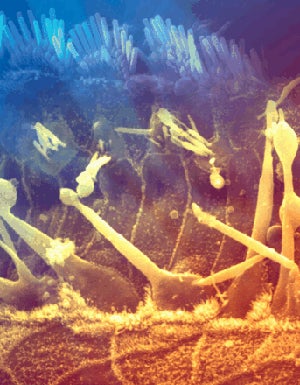 Genetically-Engineered Hairs Improve the Human Ear
