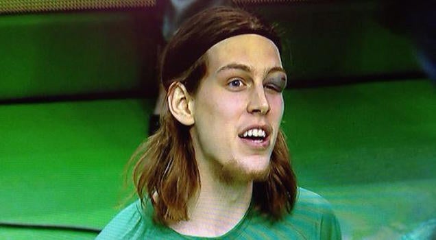 <b>Kelly Olynyk</b> Became The First Cyclops To Play In The NBA | City of Brotherly <b>...</b> - s6iq5zjugjxcweookze1