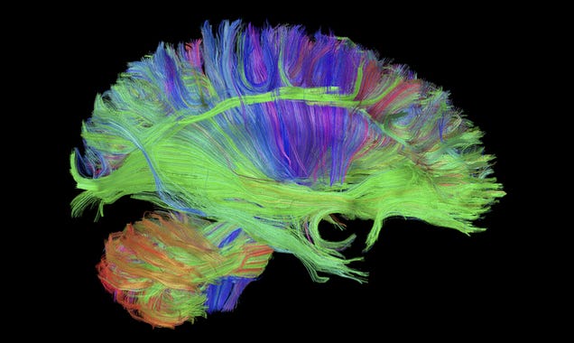 This Is How GE S MRI Scanner Sees Your Brain Gizmodo UK