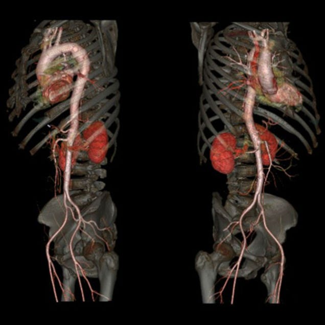 Un nuevo escáner logra estas increíbles imágenes de nuestro cuerpo