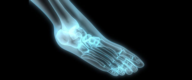Your Bones Don't Shatter Because They're Full of Goo