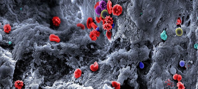 This Is What a Blood Clot Looks Like Close-Up
