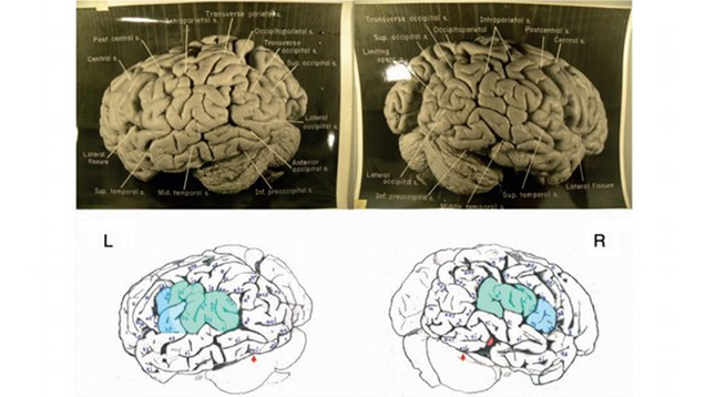 Albert Einstein brain holland township school webpage