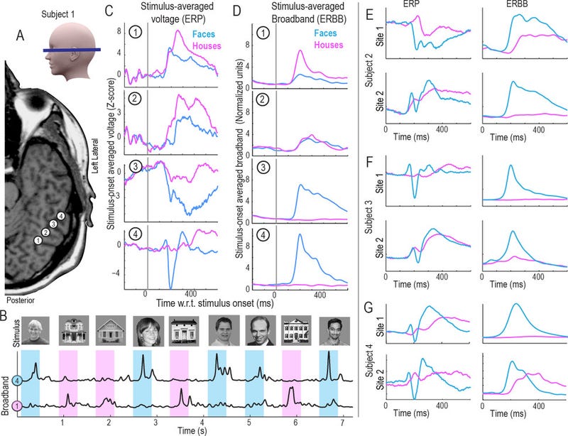 New Technique Allows Scientists to Read Minds at Nearly the Speed of Thought