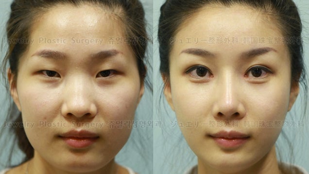 How South Korean Plastic Surgeons Make Passport Photos Worthless