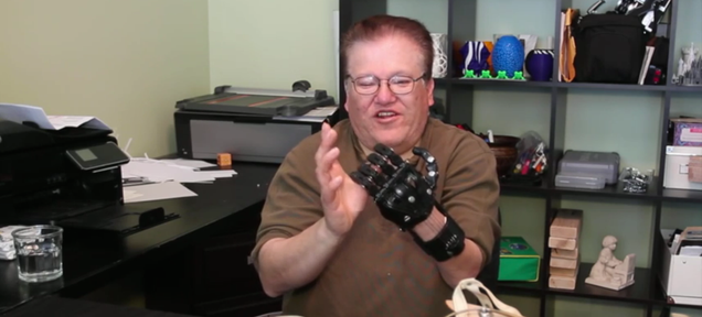 Man Explains Why He Prefers $50 3D-Printed Hand to $42,000 Prosthesis