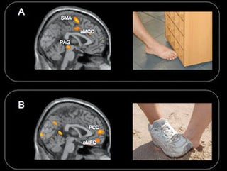 Brain Scans Reveal that Teen Bullies Get Pleasure from Your Pain