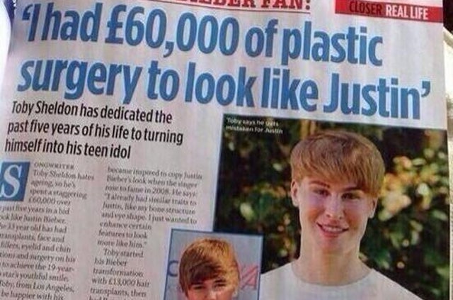 Songwriter Spends Life Savings On Surgeries To Look Like Justin Bieber