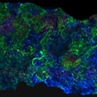 Artificial Bone That Morphs Into Tendons