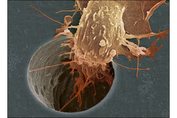 Where Is My Cure for Cancer?