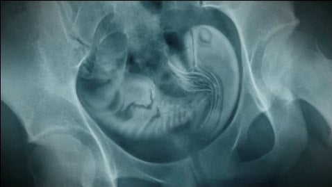 Turkish Alien Babies Load Up For A Russian Revolution, Plus Grzegorz Jonkajtys' Ark