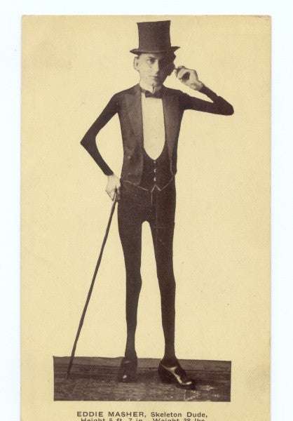 Glamour shots of carnival "freaks" of the 1800s were oddly touching