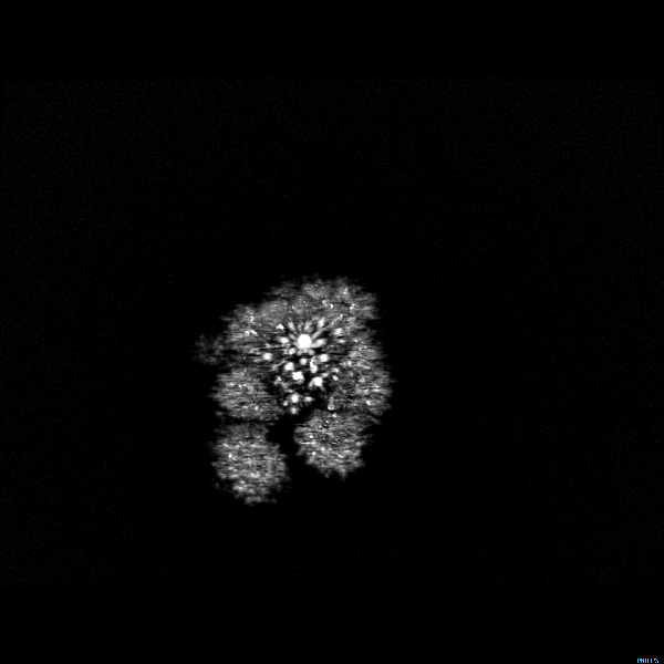 What do fruits and vegetables look like inside an MRI? Short answer: "Whoa."