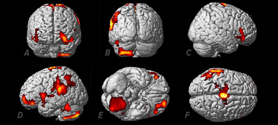 Scientists unlock mystery of out-of-body experiences (aka astral trips)