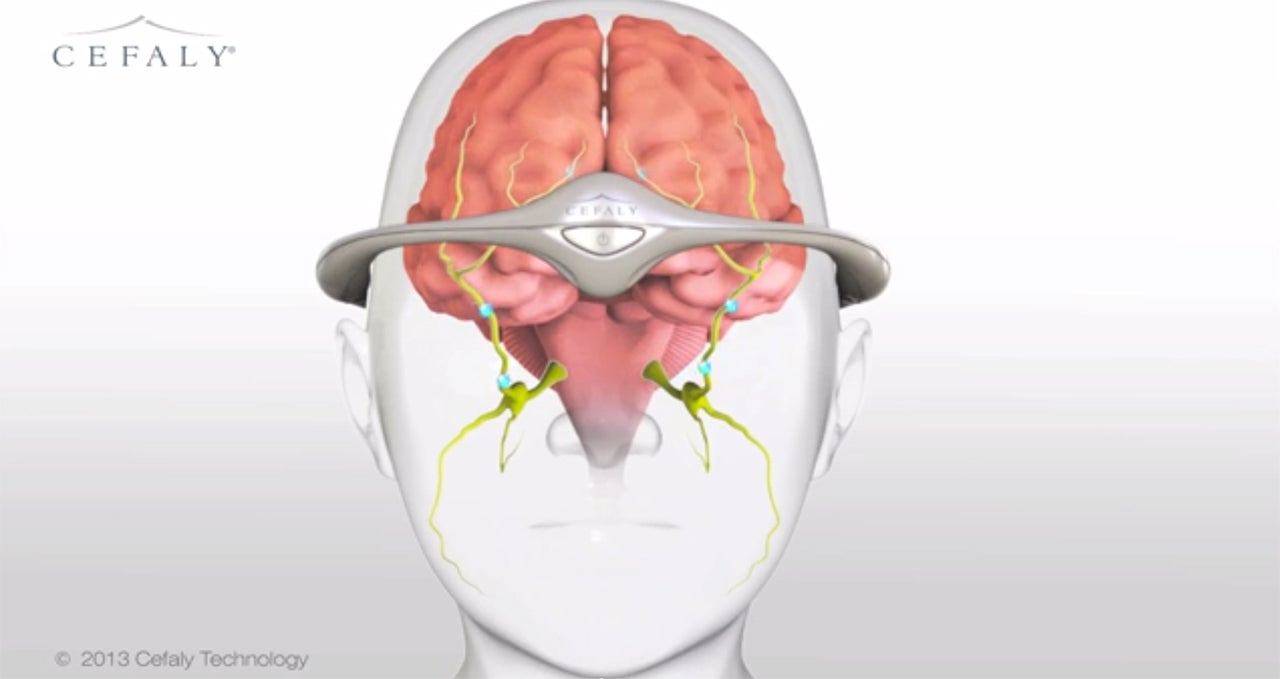 Migraine-Blasting Electric HeadbandIs Coming to The U.S.