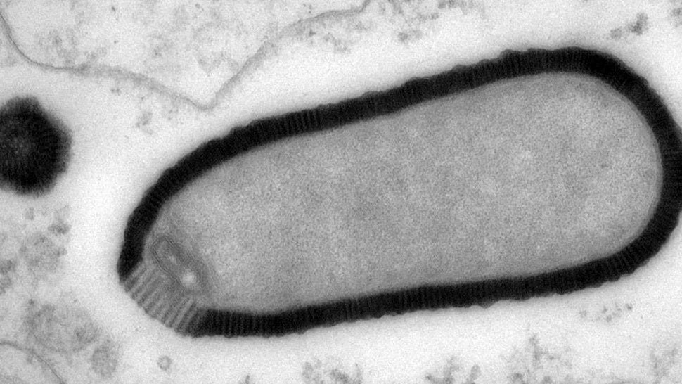 French Scientists Revive Enormous 30,000-Year-Old Virus Because Why Not