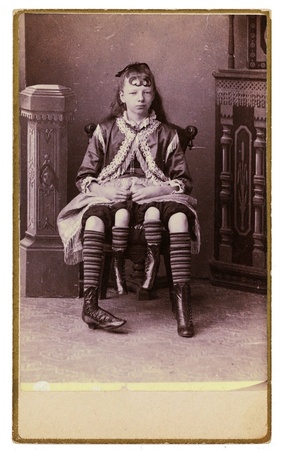 Glamour shots of carnival "freaks" of the 1800s were oddly touching