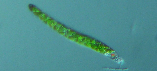 Bio-Inspired Gel Could Create 'Graceful' Robots That Move Like Humans