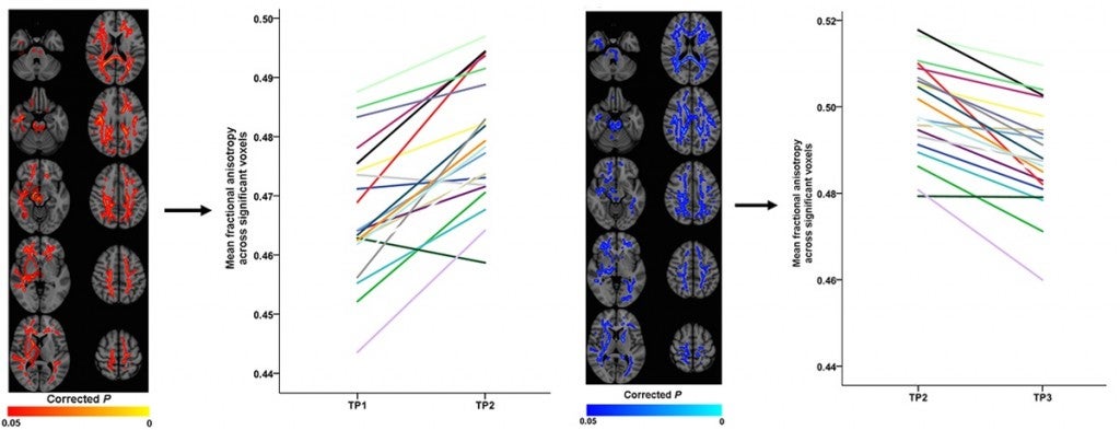 Those All-Nighters You Pull May Not Be as Harmless as You Think