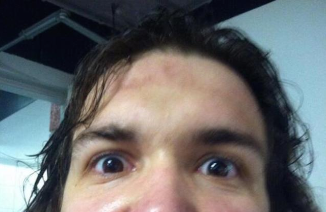 Red Wings Prospect Takes Puck To Mouth, Tweets Photo Of Afterma…