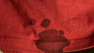 How To Remove Blood Stains