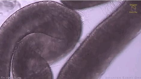 Science Reveals The Right Way To Treat A Man O War Sting