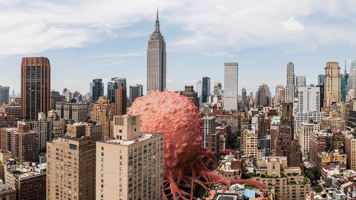 Cancer Researchers Tout Huge Strides In Fight Against 350-Foot-Tall Tumor Terrorizing Manhattan