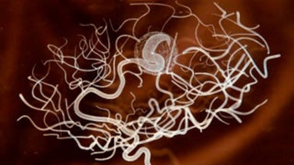 A Neuroscientist Who Lost Her Mind Says It Can Happen To Anyone a-neuroscientist-who-lost-her-mind-says-it-can-happen-to-anyone