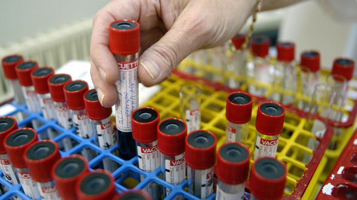 Blood donor study estimates that more than 80% of American adults now have antibodies to coronavirus