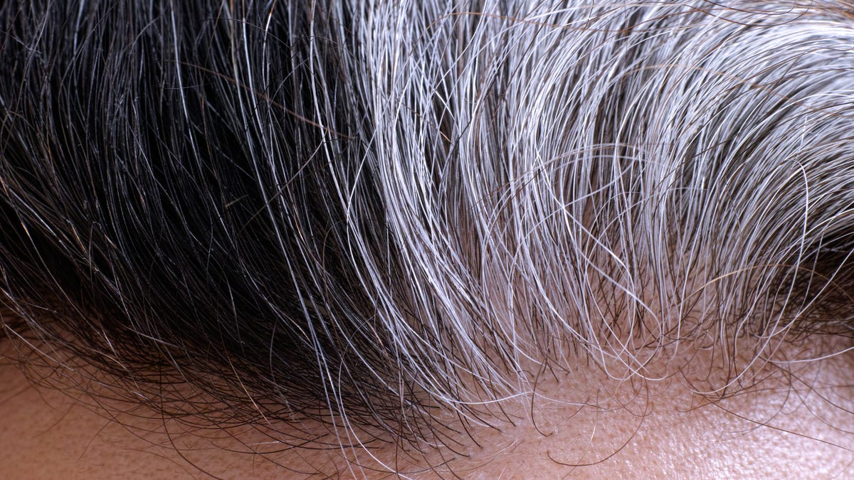 A study seems to have identified the cause of gray hair