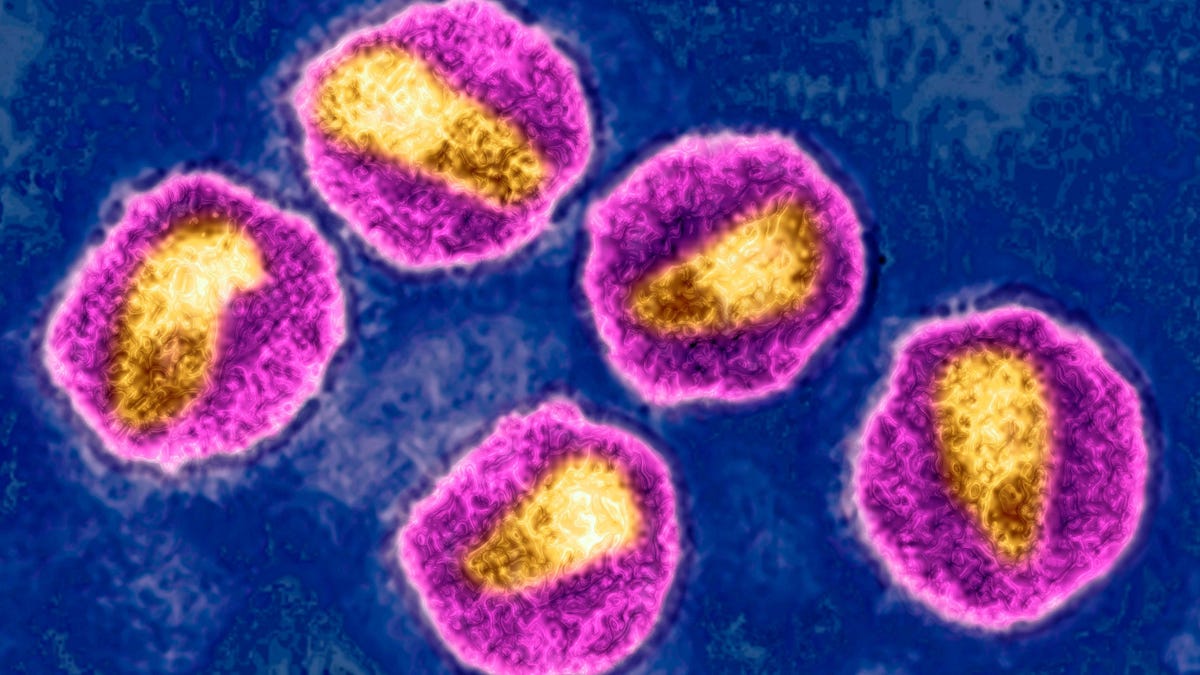 A Highly Virulent Variant of HIV Has Been Discovered in the Netherlands – Gizmodo