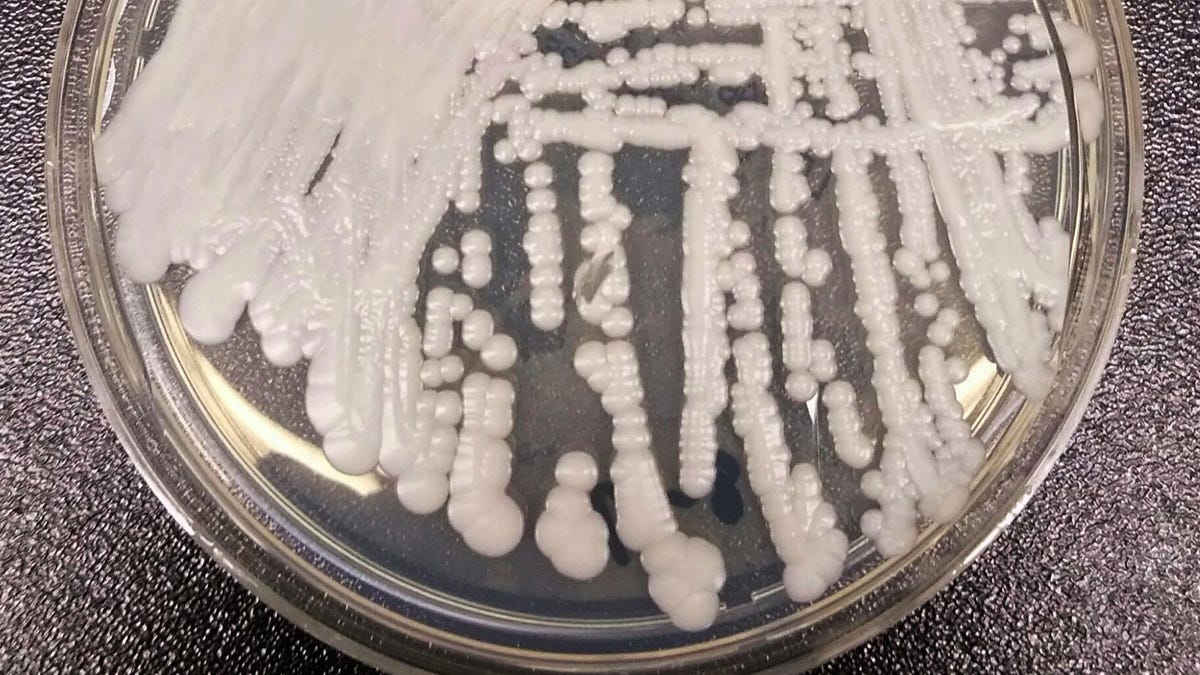 Deadly Superbug Yeast Sickens Patients at Oregon Hospital – Gizmodo