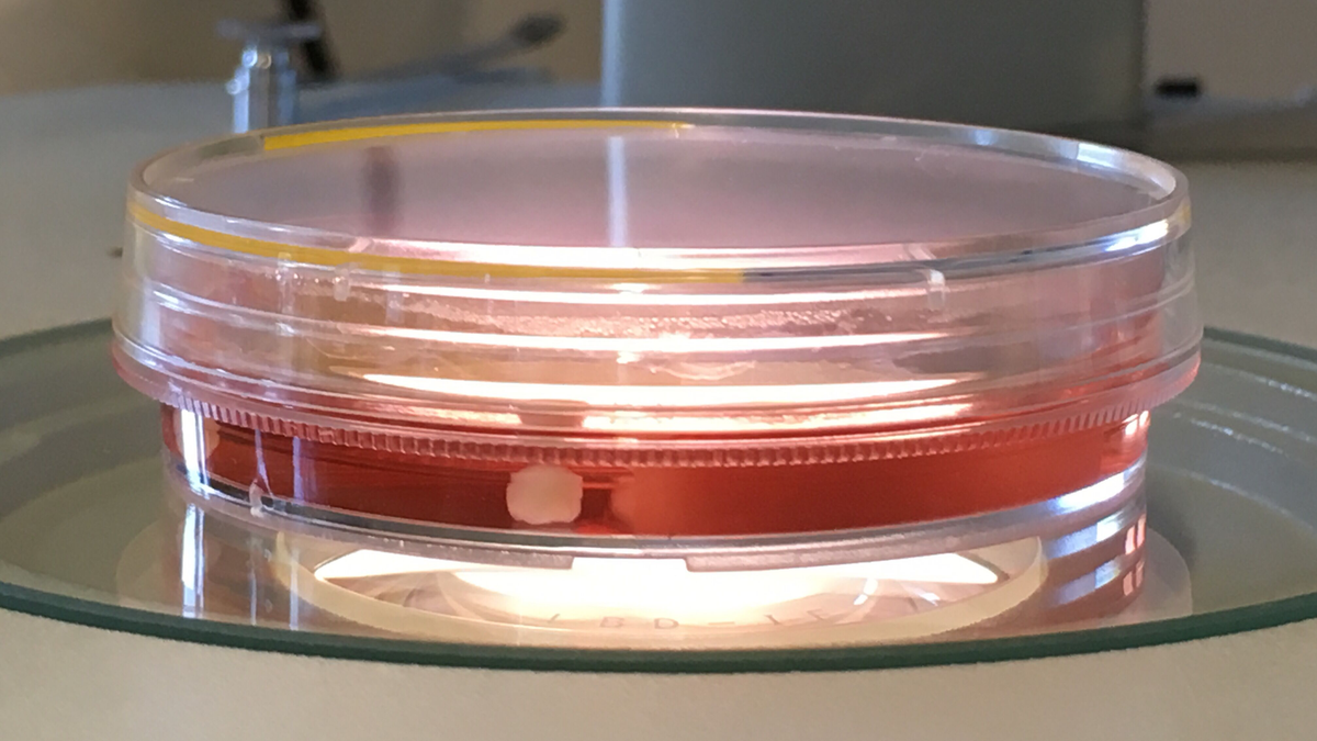 Scientists Use Lab-Grown Brains to Study What Makes Us Human