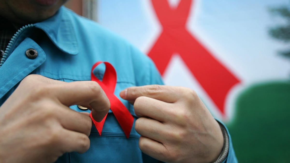 Scientists Say a Second HIV Patient Cleared the Virus Naturally – Gizmodo