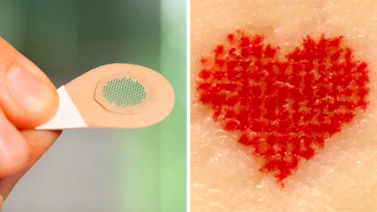 Microneedle Tattooing now is fast painless due to new microneedle  technique Details here  The Economic Times