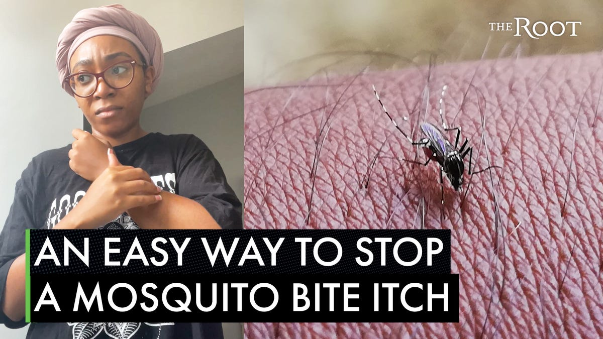 Mosquito Bite? Here's A Hack In Every Home That'll Stop the Itch