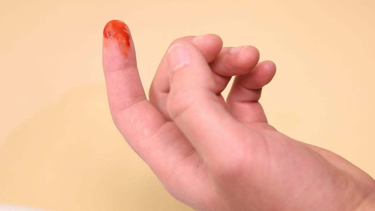 Bleeding from Sharp Cut Wound at Left Index. Finger Cut, Bleeding Injured  with Knife Stock Photo - Image of natural, droplet: 177485556