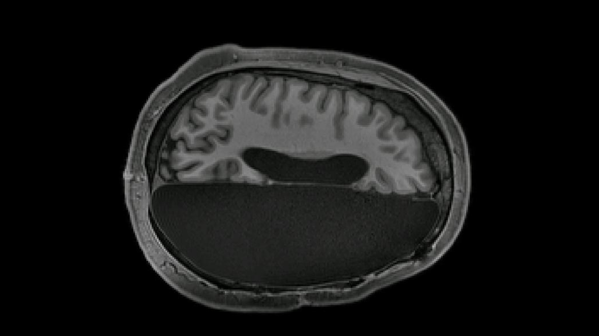 Remarkable Scans Show How The Human Brain Rewires Itself