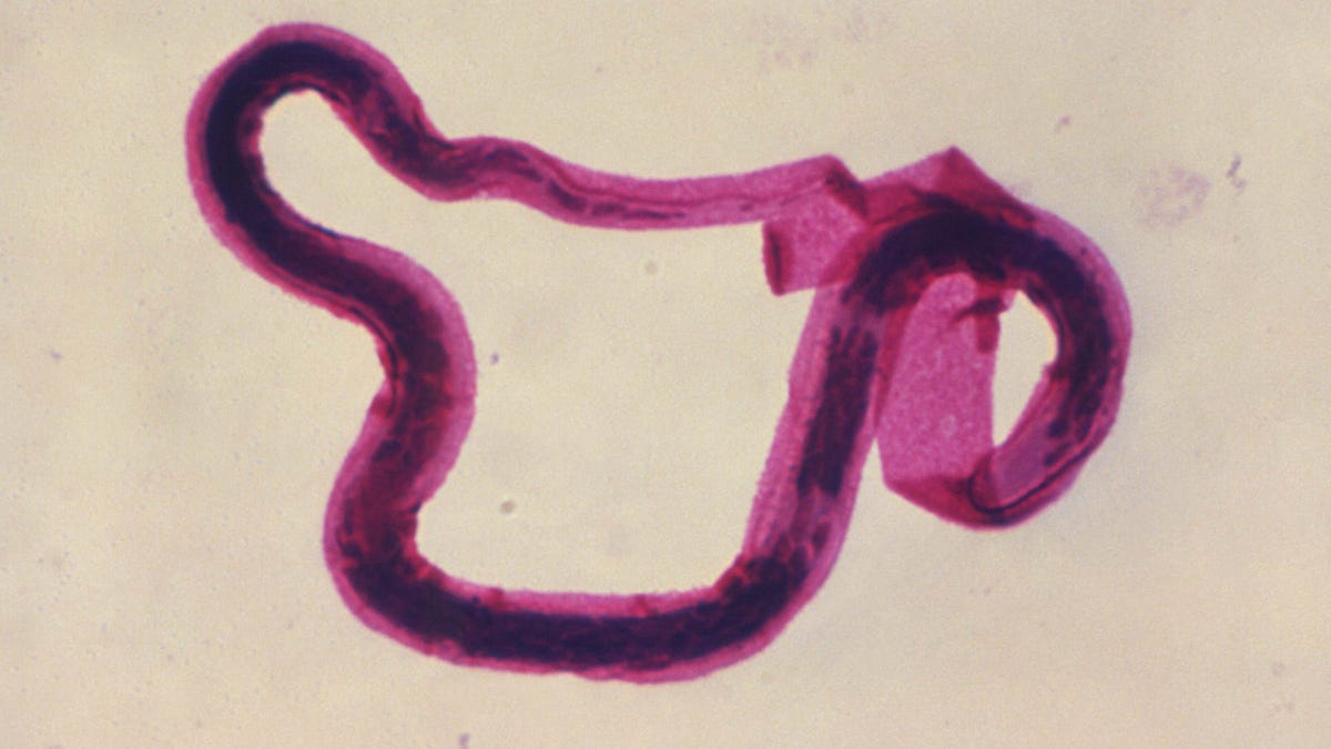 A Man's Worm Infection Left Him with a 'Stony Hard' Testicle