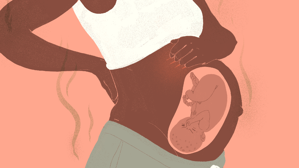 What To Do About The Weird Gross Things That Happen To Your Pregnant Body